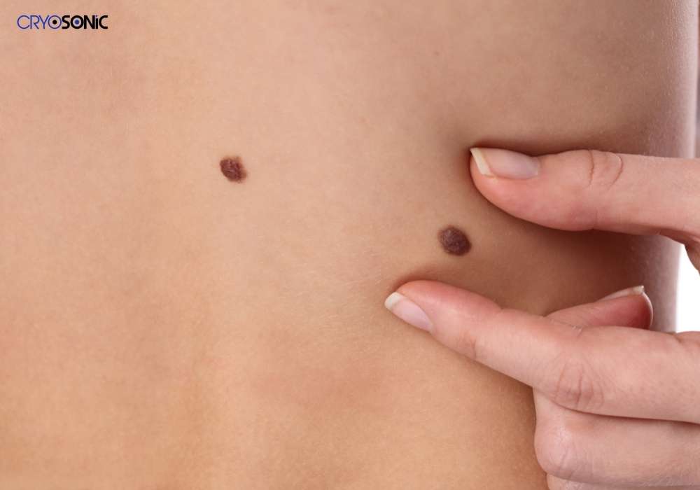 Infection Risk and Poor Aftercare Dartford